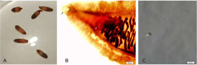 fluke worm in stool