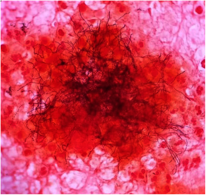 Actinomyces meyeri gram stain
