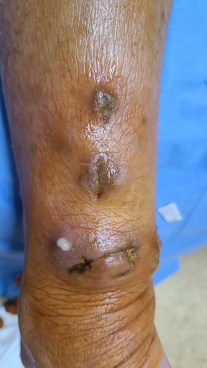 search terms for literature review figure 1