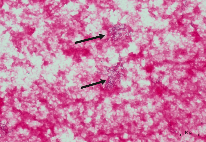 search terms for literature review figure 2