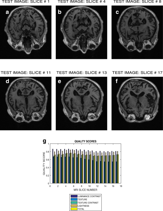 normal brain mri with contrast