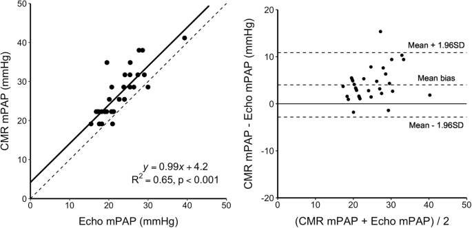 Cardiovascular Magnetic Resonance 4d Flow Analysis Has A Higher Diagnostic Yield Than Doppler Echocardiography For Detecting Increased Pulmonary Artery Pressure Springerlink Cardiovascular Magnetic Resonance 4d Flow Analysis Has A Higher Diagnostic Yield Than Doppler Echocardiography For Detecting Increased Pulmonary Artery Pressure Springerlink