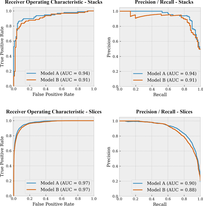 Automated detection of pulmonary embolism from CT-angiograms using deep  learning | BMC Medical Imaging | Full Text