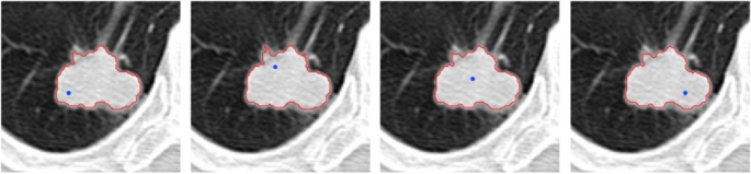 figure 20