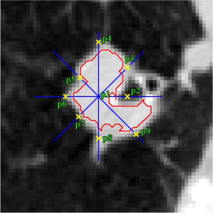 figure 21