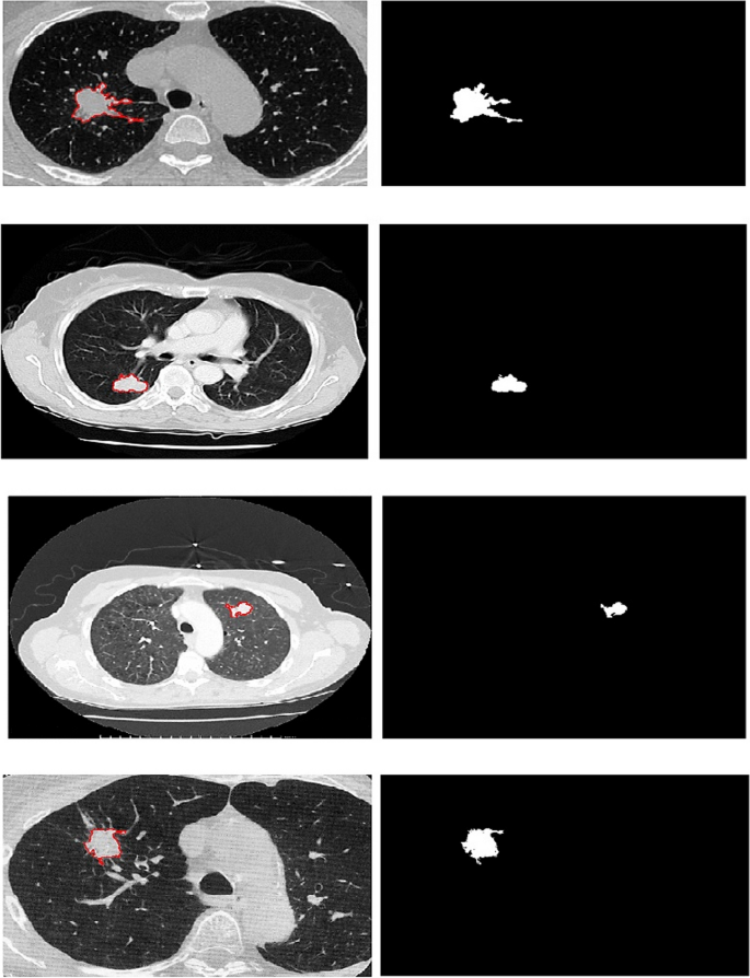 figure 24