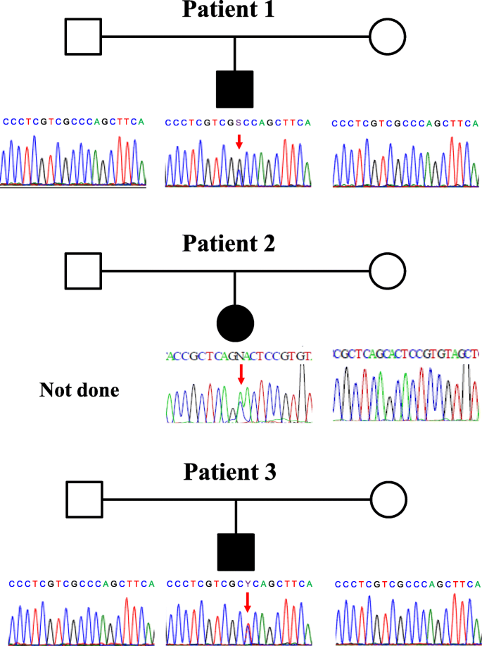 Three Cases Of Multicentric Carpotarsal Osteolysis Syndrome A Case Series Bmc Medical Genetics Full Text
