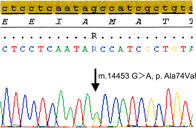 Late-onset MELAS syndrome with mtDNA 14453G→A mutation masquerading as an  acute encephalitis: a case report | BMC Neurology | Full Text