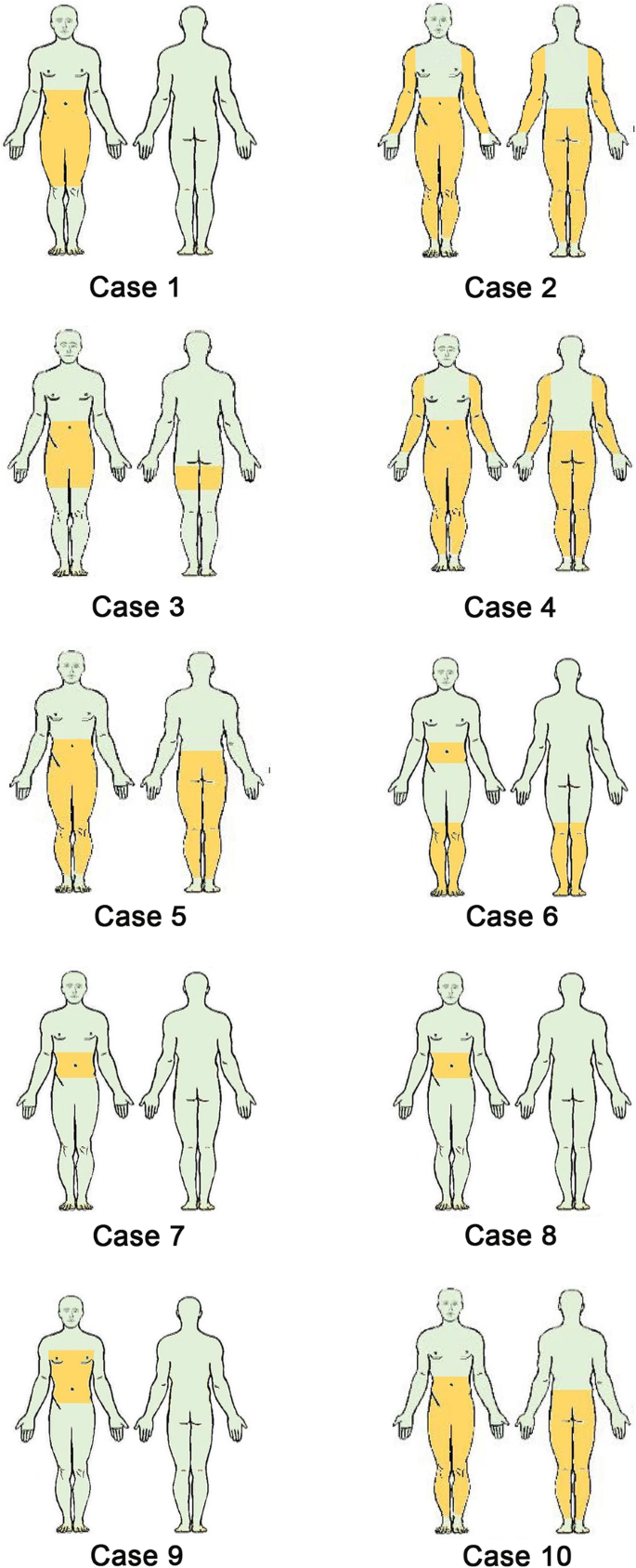 Restless abdomen: a spectrum or a phenotype variant of restless legs  syndrome? | BMC Neurology | Full Text