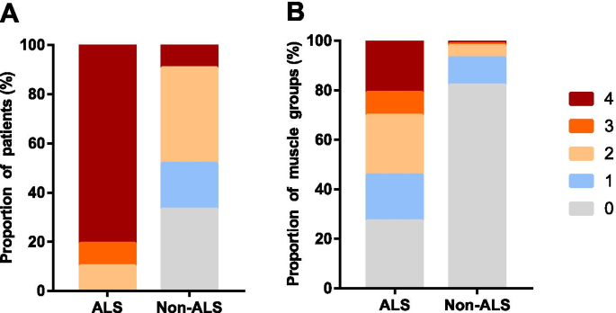 Fasciculation differences between ALS and non-ALS patients: an ...