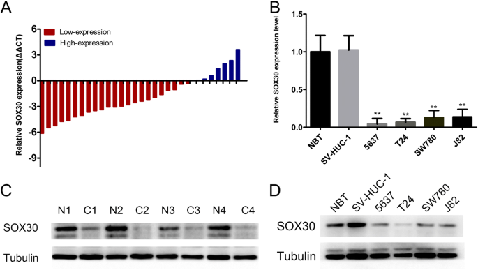 Decreased expression of SRY-box containing gene 30 is related to malignant  phenotypes of human bladder cancer and correlates with poor prognosis | BMC  Cancer | Full Text