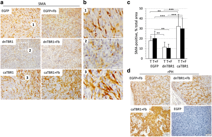 Tgf B Signaling Promotes Tumor Vasculature By Enhancing The Pericyte Endothelium Association Bmc Cancer Full Text