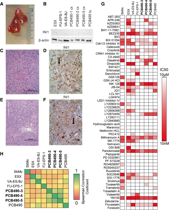 Probabilistic modeling of personalized drug combinations from integrated  chemical screen and molecular data in sarcoma | BMC Cancer | Full Text