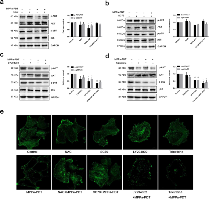 Mppa Pdt Suppresses Breast Tumor Migration Invasion By Inhibiting Akt Nf Kb Dependent Mmp 9 Expression Via Ros Bmc Cancer Full Text