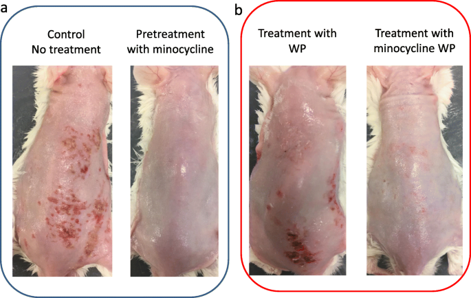 Minocycline Prevents And Repairs The Skin Disorder Associated With Afatinib One Of The Epidermal Growth Factor Receptor Tyrosine Kinase Inhibitors For Non Small Cell Lung Cancer Bmc Cancer Full Text