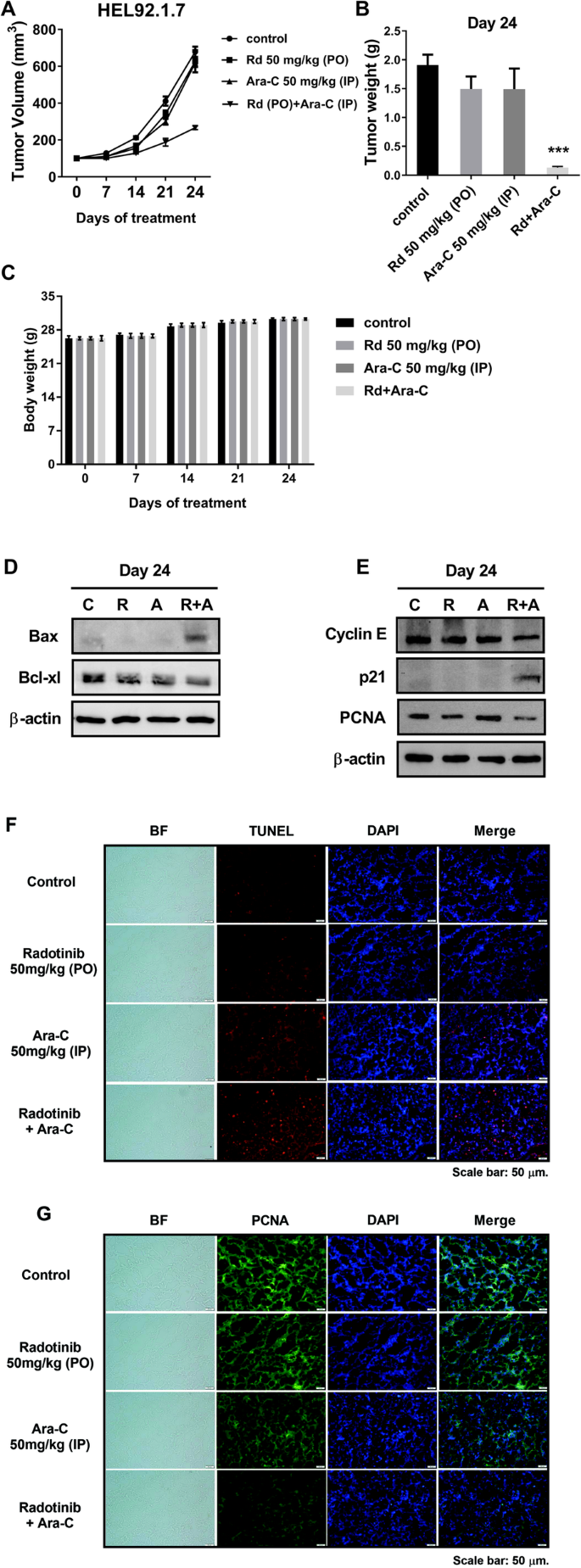 Radotinib enhances cytarabine (Ara-C)-induced acute myeloid leukemia cell  death | BMC Cancer | Full Text