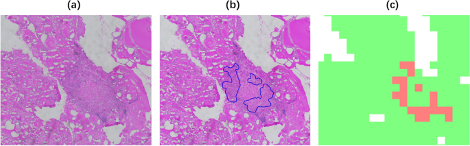 current research on thyroid cancer figure 13