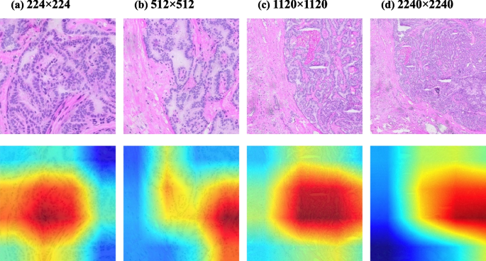 current research on thyroid cancer figure 14