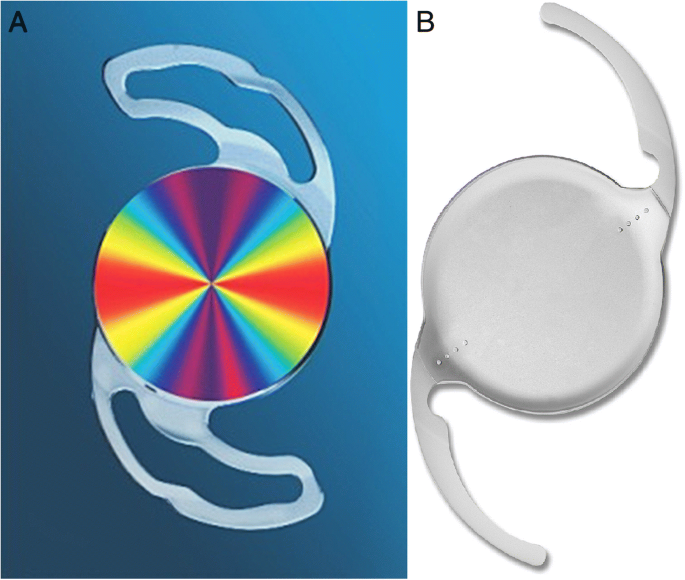 Comparison of clinical outcomes of toric intraocular lens, Precizon vs  Tecnis: a single center randomized controlled trial | BMC Ophthalmology |  Full Text