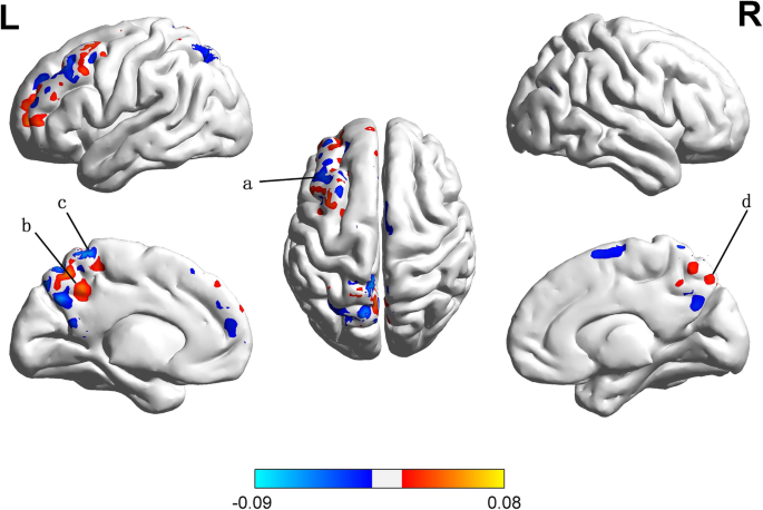 Exploring memory function in earthquake trauma survivors with resting-state  fMRI and machine learning | BMC Psychiatry | Full Text