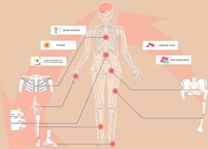 new research on osteoporosis figure 4