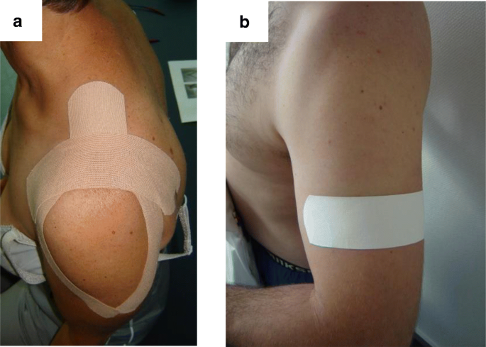 Immediate and short-term effects of kinesiotaping on muscular activity,  mobility, strength and pain after rotator cuff surgery: a crossover  clinical trial | BMC Musculoskeletal Disorders | Full Text