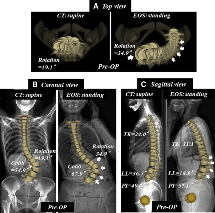 lumbar spine xray