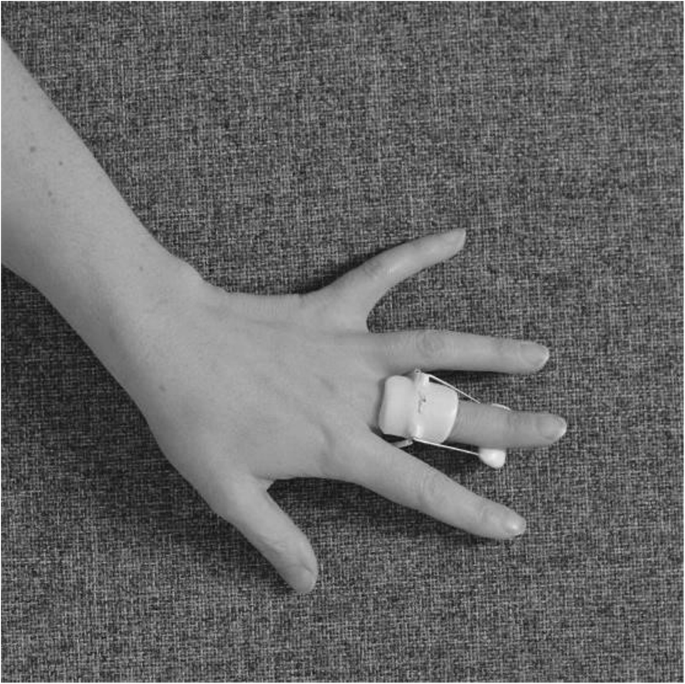 Hand Therapy Or Not Following Collagenase Treatment For Dupuytren S Contracture Protocol For A Randomised Controlled Trial Springerlink