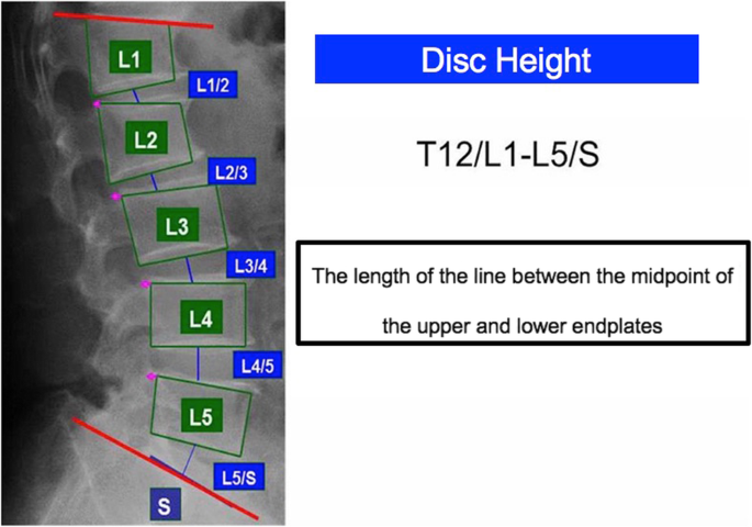 Relationship Between X Ray Findings Of Lumbar Spondylosis And Knee Pain Bmc Musculoskeletal Disorders Full Text