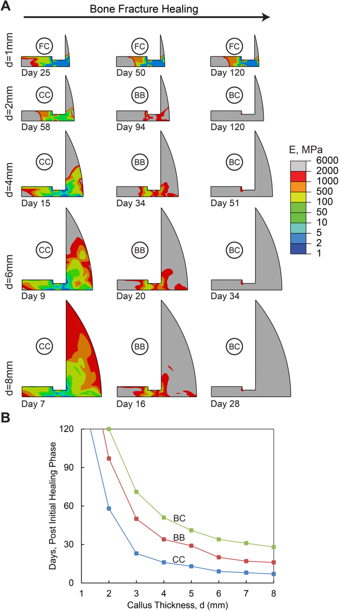 Computational modeling of human bone fracture healing affected by different  conditions of initial healing stage | BMC Musculoskeletal Disorders | Full  Text