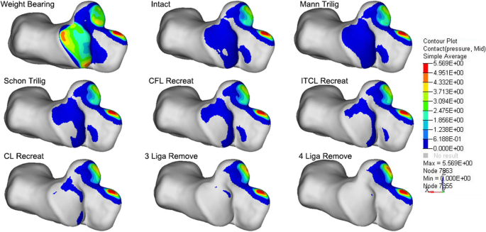 Biomechanical comparison of tenodesis reconstruction for subtalar  instability: a finite element analysis | BMC Musculoskeletal Disorders |  Full Text