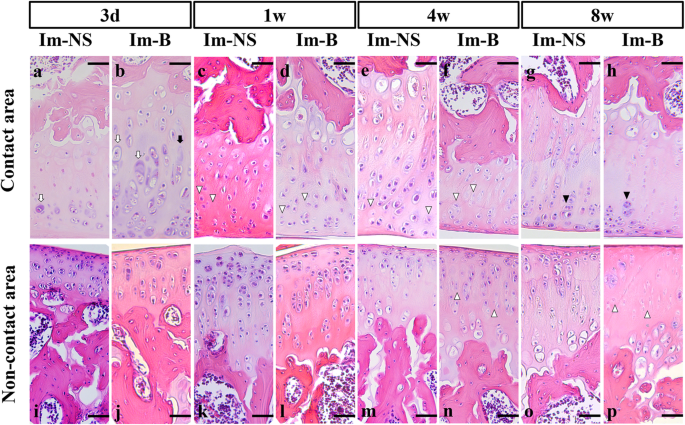 articular cartilage histology