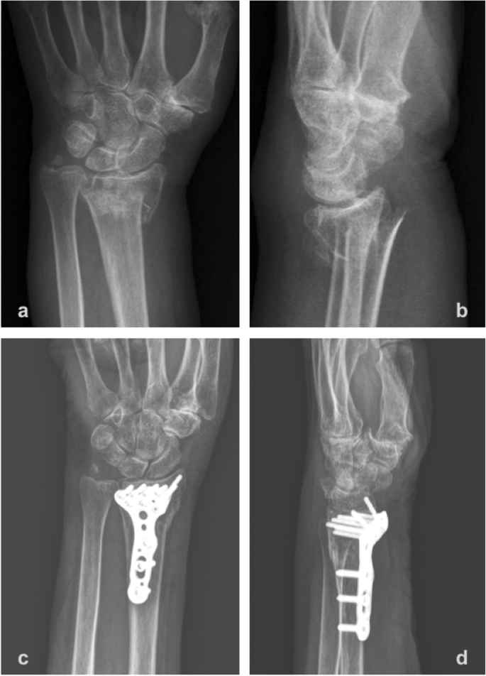 oda de tratament articular