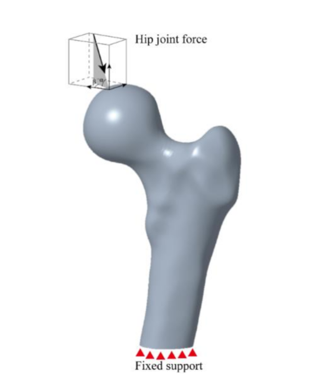 case study fracture neck of femur figure 2