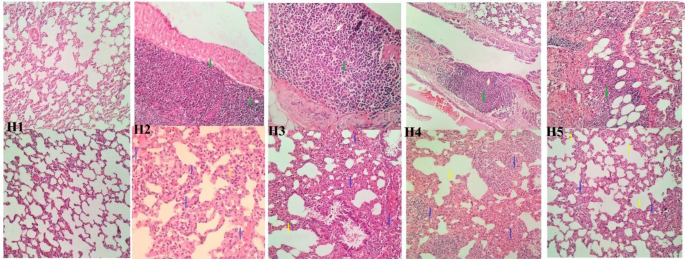 N-Acetylcysteine as an anti-oxidant and anti-inflammatory agent in  decreasing histopathological damages and oxidative stress after mercury  exposure in lung tissue of rats | BMC Biotechnology | Springer Nature Link