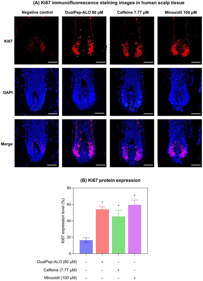 ghk-cu vegf angiogenesis hair growth Co-delivery of bioactive peptides by nanoliposomes for promotion of hair  growth main image 1