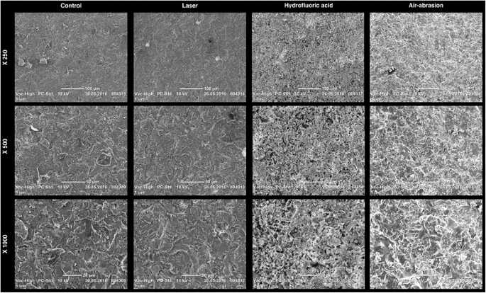 Light transmittance and surface roughness of a feldspathic ceramic CAD-CAM  material as a function of different surface treatments | BMC Oral Health |  Full Text