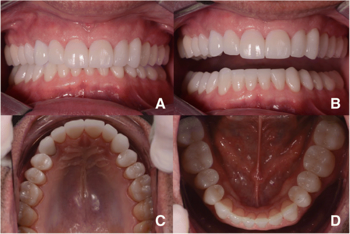 figure 15