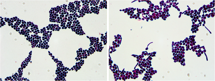 Какое взаимное расположение кокков имеют сарцины Cariogenicity of Candida albicans of distinct genotypes among 3-5-year-old Uygur