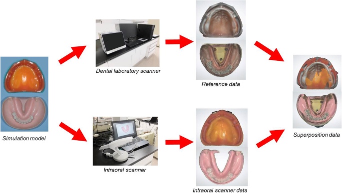 Applying intraoral scanner to residual ridge in edentulous regions: in  vitro evaluation of inter-operator validity to confirm trueness | BMC Oral  Health | Full Text