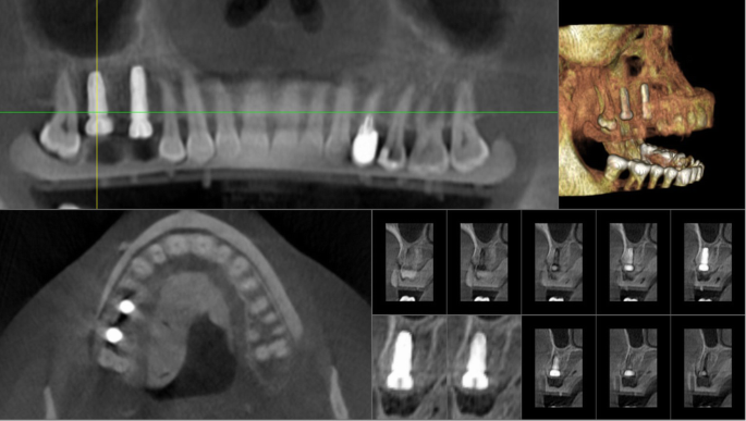 figure 15