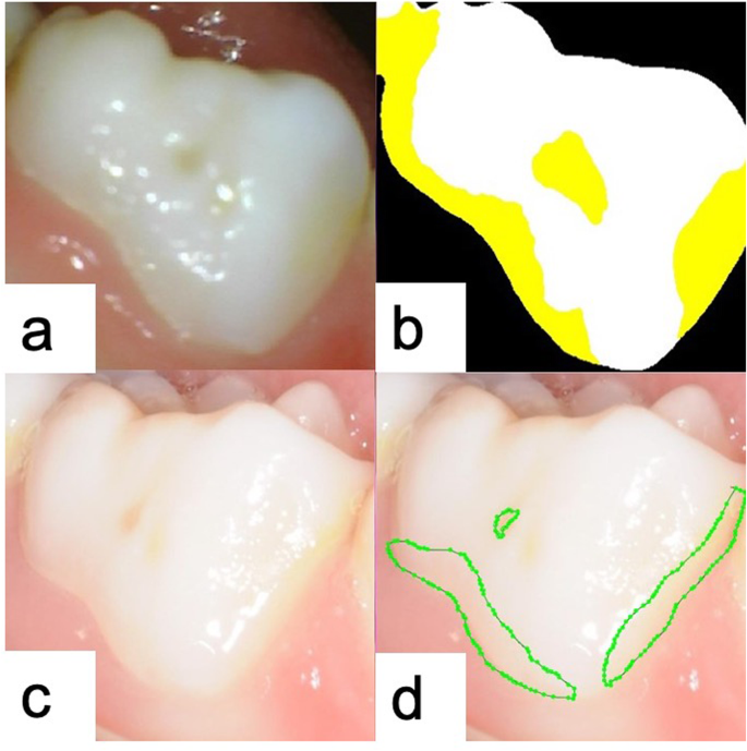 figure 4