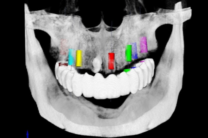 figure 4