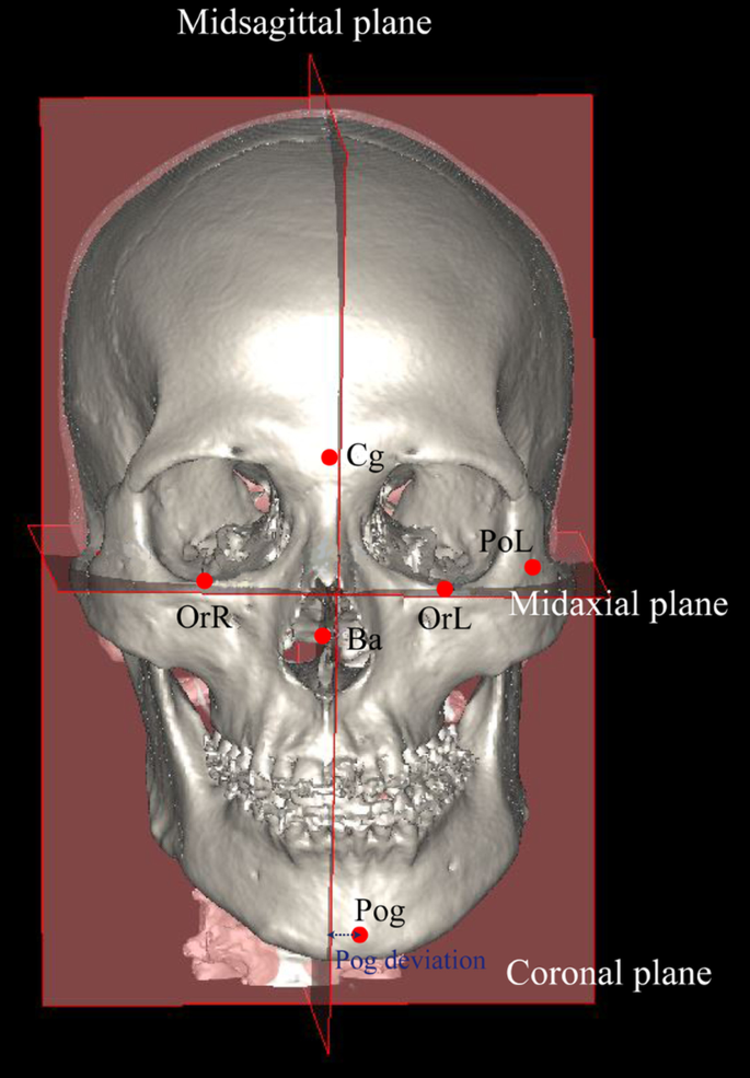 Inferior alveolar nerve, Radiology Reference Article