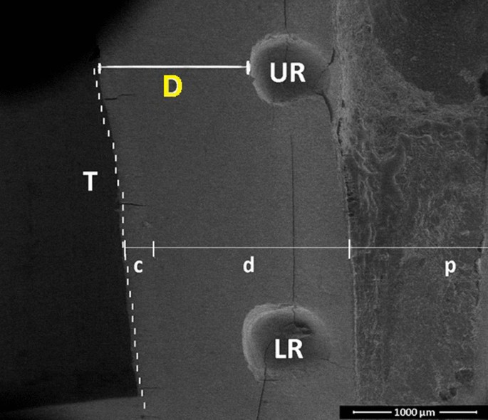 Influence of scaler tip design on root surface roughness, tooth 