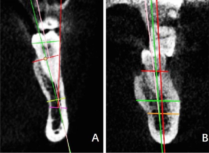 figure5