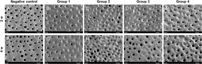 Desensitizing toothpastes for dentin sealing and tertiary dentin formation  in vitro and in vivo: a comparative analysis | BMC Oral Health | Full Text