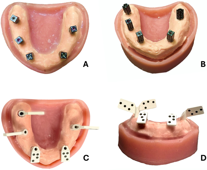 Effect of implant angulation on the trueness and precision of intraoral ...