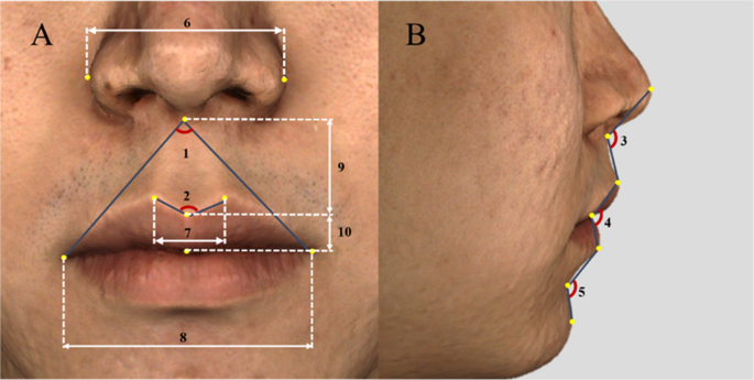 Fig. 3