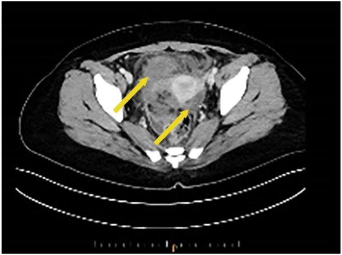 figure 9